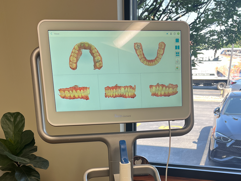 Invisalign & Cosmetic Dentistry