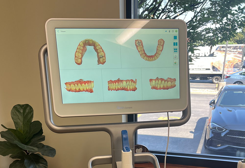 Invisalign & Cosmetic Dentistry at Mesolella Dental, Rochester NY
